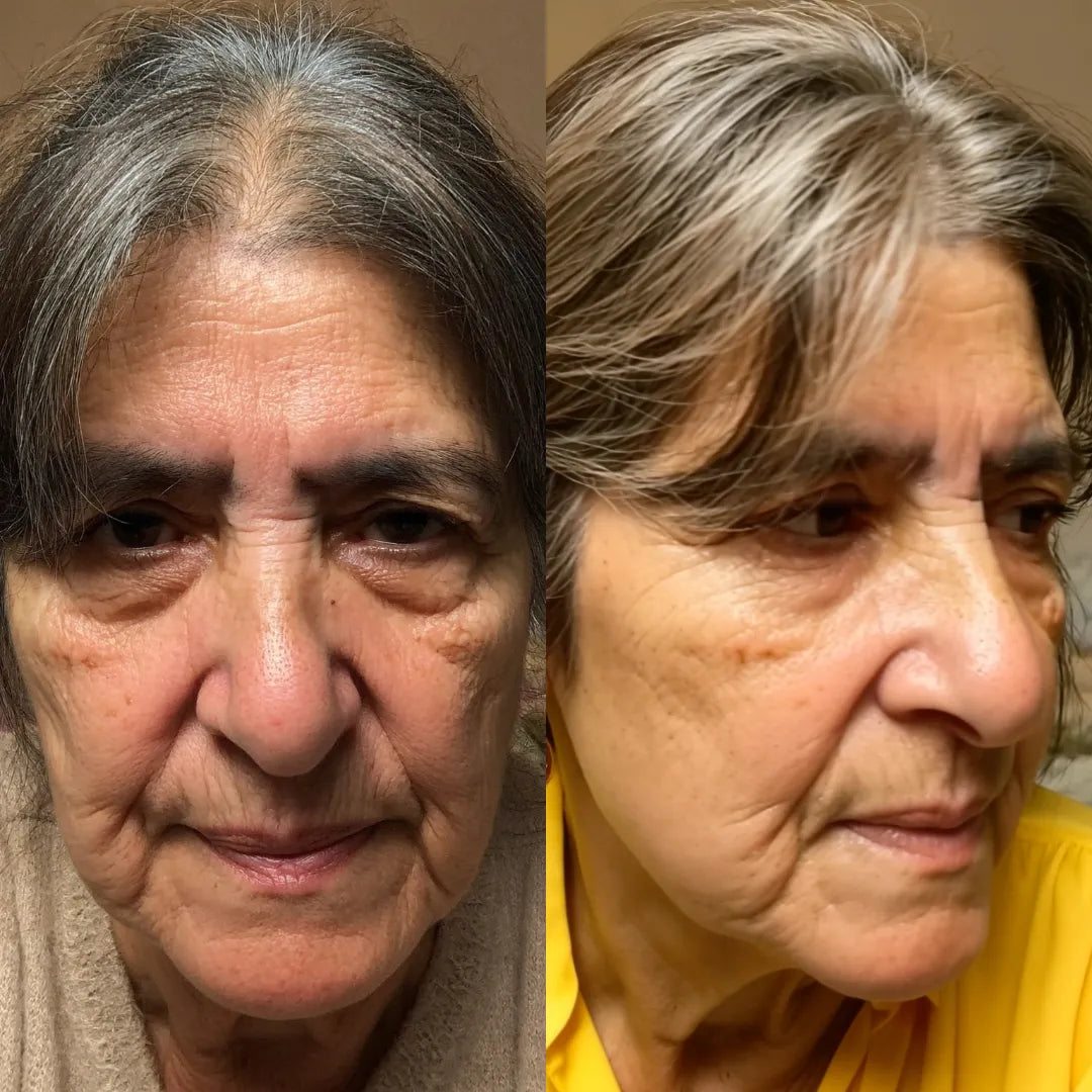 Revital Eyes® 2-in-1 Red Light Therapy + EMS To Erase Eye Bags