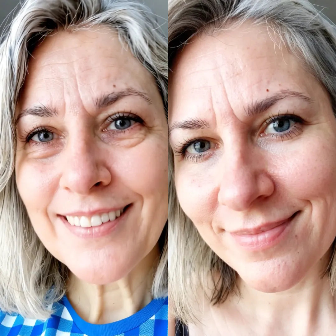 Revital Eyes® 2-in-1 Red Light Therapy + EMS To Erase Eye Bags